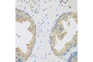 Immunohistochemistry of paraffin-embedded human prostate using ENPEP antibody at dilution of 1:200 (40x lens).