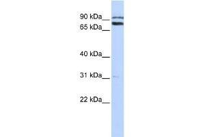WB Suggested Anti-TRIM67 Antibody Titration:  0.