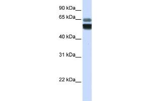 WB Suggested Anti-SMPD1 Antibody Titration:  0.