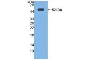 Detection of Recombinant EP3, Human using Polyclonal Antibody to Prostaglandin E Receptor 3 (EP3) (PTGER3 antibody  (AA 217-390))
