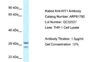 Western Blotting (WB) image for anti-Ras-Like Without CAAX 1 (RIT1) (Middle Region) antibody (ABIN786493) (RIT1 antibody  (Middle Region))