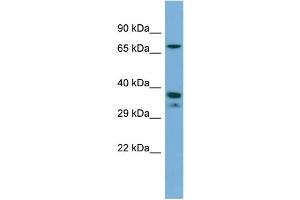 Western Blotting (WB) image for anti-Nuclear Receptor Subfamily 2, Group E, Member 1 (NR2E1) (C-Term) antibody (ABIN2782277)