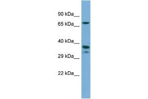 Host:  Rabbit  Target Name:  NR2E1  Sample Type:  THP-1 Whole cell lysates  Antibody Dilution:  1.