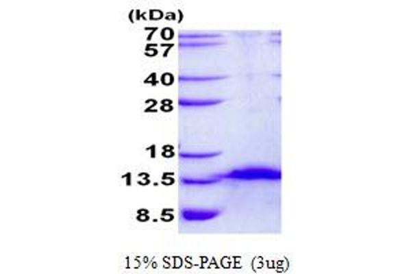 FDCSP Protein (His tag)