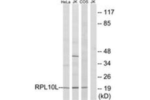 Western blot analysis of extracts from Jurkat/COS7/HeLa cells, using RPL10L Antibody. (RPL10L antibody  (AA 151-200))