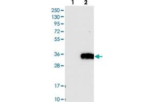Western blot analysis of Lane 1: Negative control (vector only transfected HEK293T lysate), Lane 2: Over-expression Lysate (Co-expressed with a C-terminal myc-DDK tag (~3. (LAT2 antibody)