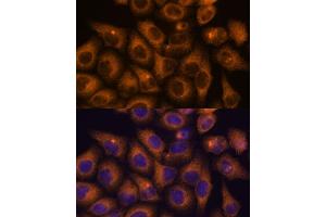 Immunofluorescence analysis of HeLa cells using CAMKV antibody (ABIN7266051) at dilution of 1:100. (CAMKV antibody  (AA 1-285))