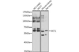 Western blot analysis of extracts of various cell lines, using  antibody (ABIN6133552, ABIN6136735, ABIN6136740 and ABIN6223092). (AKT1 antibody  (AA 50-150))