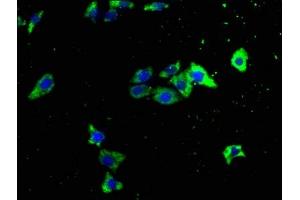 Immunofluorescence staining of HepG2 cells with ABIN7151041 at 1:133, counter-stained with DAPI. (ITCH antibody  (AA 29-303))
