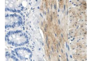 IHC-P analysis of Rat Small intestine Tissue, with DAB staining. (TLR5 antibody  (AA 325-644))