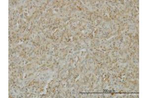 Image no. 3 for anti-Tumor Necrosis Factor (Ligand) Superfamily, Member 14 (TNFSF14) (AA 61-170) antibody (ABIN599058) (TNFSF14 antibody  (AA 61-170))