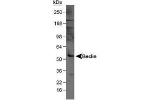 Image no. 3 for anti-Beclin 1, Autophagy Related (BECN1) antibody (ABIN363435) (Beclin 1 antibody)