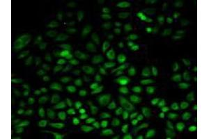 Detection of PSAT1 in Human Hela Cells using Polyclonal Antibody to Phosphoserine Aminotransferase 1 (PSAT1) (PSAT1 antibody  (AA 1-312))