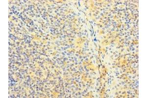Immunohistochemistry of paraffin-embedded human tonsil tissue using ABIN7170373 at dilution of 1:100
