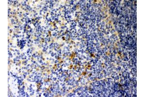 Anti- Galectin3 Picoband antibody, IHC(P) IHC(P): Mouse Spleen Tissue (Galectin 3 antibody  (AA 153-264))