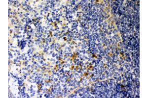 Anti- Galectin3 Picoband antibody, IHC(P) IHC(P): Mouse Spleen Tissue