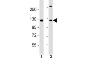 Western blot testing of human 1) A431 and 2) HeLa cell lysate with INTS6 antibody at 1:2000. (INTS6 antibody  (AA 135-167))