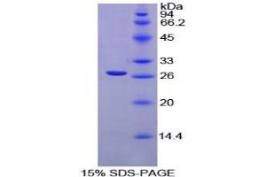 SDS-PAGE analysis of Rat XRCC6 Protein.