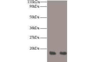 Western blot All lanes: RPA3 antibody at 2 μg/mL Lane 1: LO2 whole cell lysate Lane 2: HepG2 whole cell lysate Secondary Goat polyclonal to rabbit IgG at 1/10000 dilution Predicted band size: 14 kDa Observed band size: 14 kDa (RPA3 antibody  (AA 1-119))