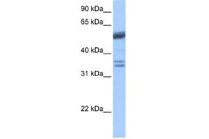 WB Suggested Anti-COIL Antibody Titration: 0. (Coilin antibody  (C-Term))