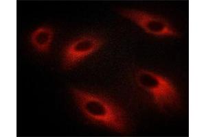 ABIN6267613 staining C6 cells treated with λ phosphatase by ICC/IF. (PKC zeta antibody  (pThr410))
