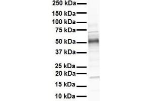 WB Suggested Anti-GREB1 antibody Titration: 1 ug/mL Sample Type: Human heart (GREB1 antibody  (N-Term))