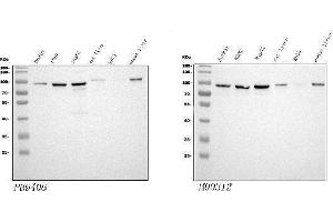 Western blot analysis of STIM1 using anti-STIM1 antibody (ABIN3043940), Left) and anti-STIM1 antibody (ABIN7606404), Right).