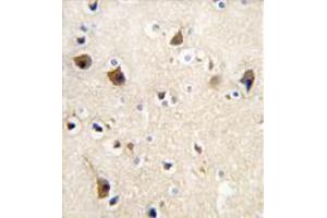 Image no. 3 for anti-Calmodulin 1 (Calm1) (C-Term) antibody (ABIN357122) (Calmodulin 1 antibody  (C-Term))