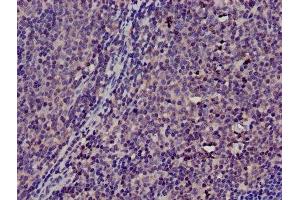 Immunohistochemistry of paraffin-embedded human lymph node tissue using ABIN7172131 at dilution of 1:100 (TMSB4X antibody  (AA 6-44))