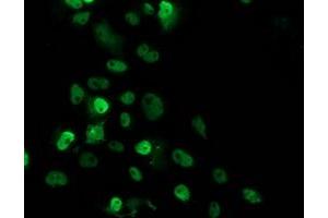 Anti-TP53 mouse monoclonal antibody (ABIN2454638) immunofluorescent staining of COS7 cells transiently transfected by pCMV6-ENTRY TP53 (RC200003). (p53 antibody)