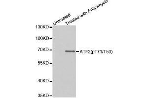 Western blot analysis of extracts from HUVEC cells untreated or treated with Anisomycin, using Phospho-ATF2-T53 antibody. (ATF2 antibody  (pThr71))