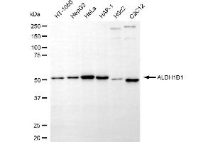 Western blotting analysis using ALDH1B1 antibody (ABIN7797559).