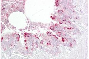 Anti-EBP1 antibody IHC staining of human lung, respiratory epithelium. (PA2G4 antibody  (AA 301-350))