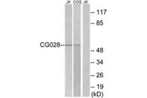 Western Blotting (WB) image for anti-CCZ1 Homolog, Vacuolar Protein Trafficking and Biogenesis Associated (CCZ1) (AA 411-460) antibody (ABIN2890813) (CCZ1 / CGI-43 antibody  (AA 411-460))