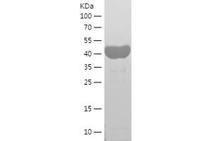 Western Blotting (WB) image for Septin 2 (SEPT2) (AA 1-361) protein (His tag) (ABIN7282661) (Septin 2 Protein (SEPT2) (AA 1-361) (His tag))