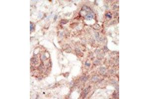 Immunohistochemistry (Paraffin-embedded Sections) (IHC (p)) image for anti-Fms-Related tyrosine Kinase 3 (FLT3) (C-Term) antibody (ABIN359869)