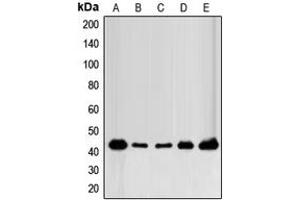Western blot analysis of FOP expression in MCF7 (A), MDAMB231 (B), MDAMB435 (C), mouse brain (D), rat brain (E) whole cell lysates. (FGFR1OP antibody  (C-Term))