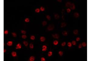 ABIN6266831 staining HeLa by IF/ICC. (ZNF225 antibody  (C-Term))