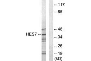 Western blot analysis of extracts from NIH-3T3 cells, using HEXIM1 Antibody. (HEXIM1 antibody  (AA 181-230))