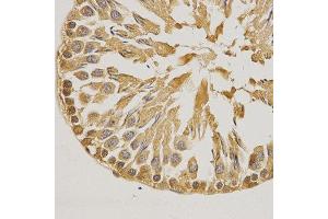 Immunohistochemistry (IHC) image for anti-Small Ubiquitin Related Modifier Protein 1 (SUMO1) (AA 1-101) antibody (ABIN3022994)