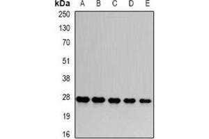 Western blot analysis of PSMA6 expression in HepG2 (A), Hela (B), mouse skeletal muscle (C), PC12 (D), COS7 (E) whole cell lysates. (PSMA6 antibody)