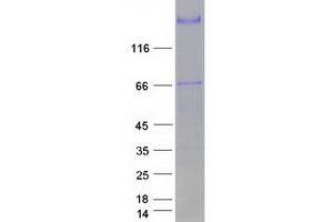 Western Blotting (WB) image for Pregnancy-Associated Plasma Protein A, Pappalysin 1 (PAPPA) protein (Myc-DYKDDDDK Tag) (ABIN2728213)