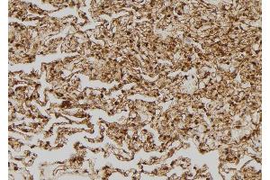 ABIN6269335 at 1/100 staining Human lung tissue by IHC-P. (BCL2L1 antibody  (Internal Region))