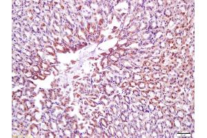 Formalin-fixed and paraffin embedded mouse stomach labeled with Anti-Calponin 1/COLP Polyclonal Antibody, Unconjugated (ABIN724820) at 1:200 followed by conjugation to the secondary antibody and DAB staining (CNN1 antibody  (AA 201-297))
