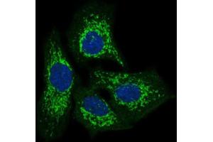 Immunofluorescence analysis of HeLa cells using TWF1 antibody (green). (TWF1 antibody  (AA 335-384))