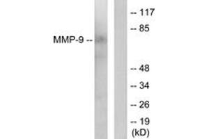 Western blot analysis of extracts from HepG2 cells, using MMP-9 Antibody. (MMP 9 antibody  (AA 651-700))