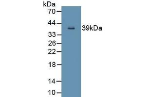 Detection of Recombinant ND5, Human using Polyclonal Antibody to NADH Dehydrogenase 5 (ND5)