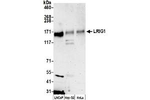 anti-Leucine-Rich Repeats and Immunoglobulin-Like Domains 1 (Lrig1) (AA 1043-1093) antibody