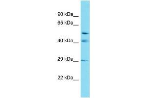 Western Blotting (WB) image for anti-Glutaredoxin, Cysteine Rich 2 (GRXCR2) (C-Term) antibody (ABIN2438093) (GRXCR2 antibody  (C-Term))