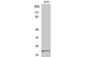 Western Blotting (WB) image for anti-Parkinson Protein 7 (PARK7) (Internal Region) antibody (ABIN3186332) (PARK7/DJ1 antibody  (Internal Region))